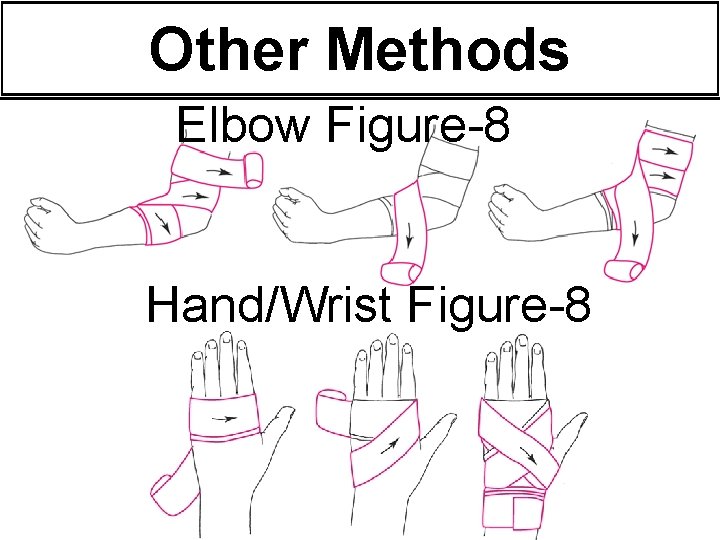 Other Methods Elbow Figure-8 Hand/Wrist Figure-8 