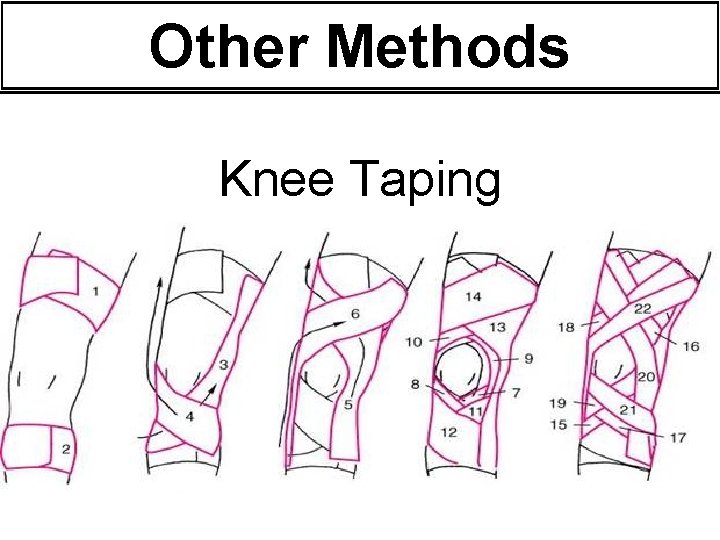 Other Methods Knee Taping Other Methods Knee Taping