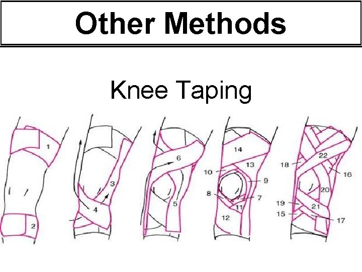 Other Methods Knee Taping 