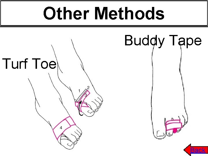 Other Methods Buddy Tape Turf Toe Back 