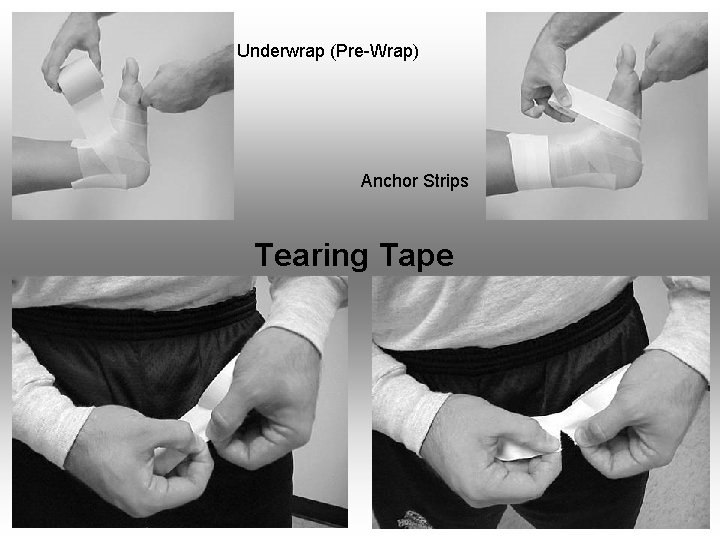  Underwrap (Pre-Wrap) Anchor Strips Tearing Tape 