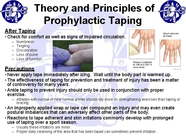  Theory and Principles of Prophylactic Taping After Taping • Check for comfort as