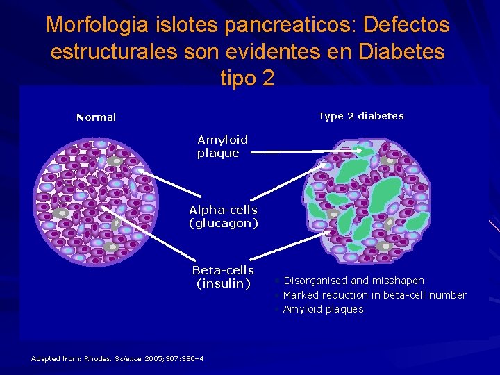 Morfologia islotes pancreaticos: Defectos estructurales son evidentes en Diabetes tipo 2 Type 2 diabetes