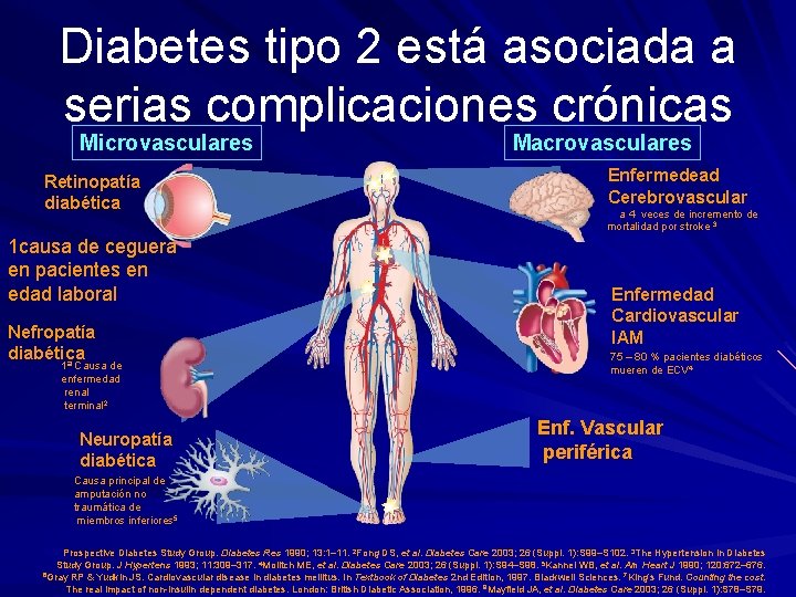 Diabetes tipo 2 está asociada a serias complicaciones crónicas Microvasculares Retinopatía diabética 1 causa
