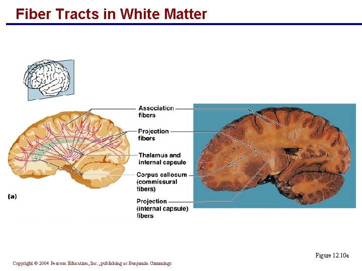 Fiber Tracts in White Matter Figure 12. 10 a Copyright © 2004 Pearson Education,