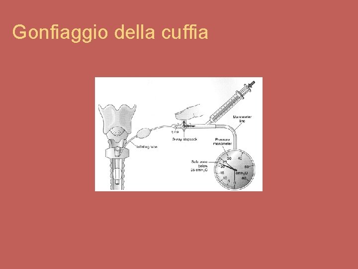 Gonfiaggio della cuffia 