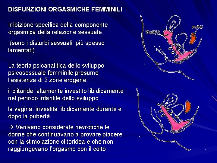 DISFUNZIONI ORGASMICHE FEMMINILI Inibizione specifica della componente orgasmica della relazione sessuale (sono i disturbi