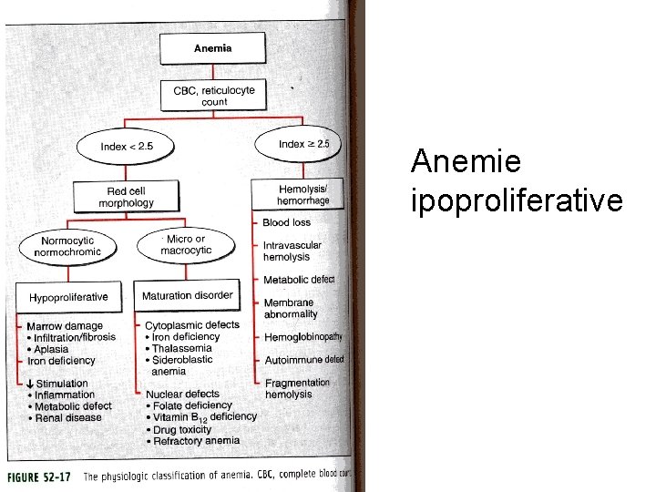 Anemie ipoproliferative 