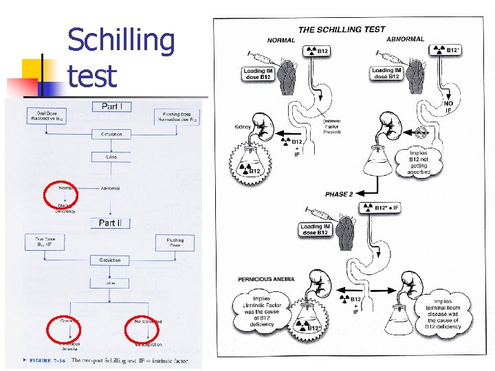 Schilling test 