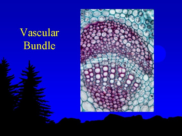 Vascular Bundle 