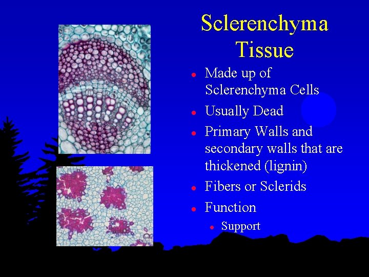 Sclerenchyma Tissue l l l Made up of Sclerenchyma Cells Usually Dead Primary Walls