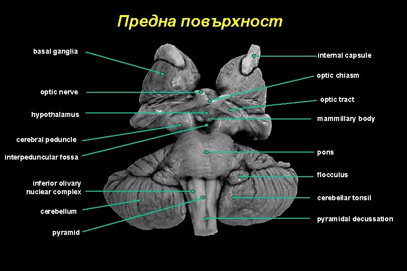 Предна повърхност basal ganglia internal capsule optic chiasm optic nerve hypothalamus optic tract mammillary