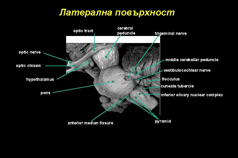 Латерална повърхност optic tract cerebral peduncle trigeminal nerve optic nerve middle cerebellar peduncle optic