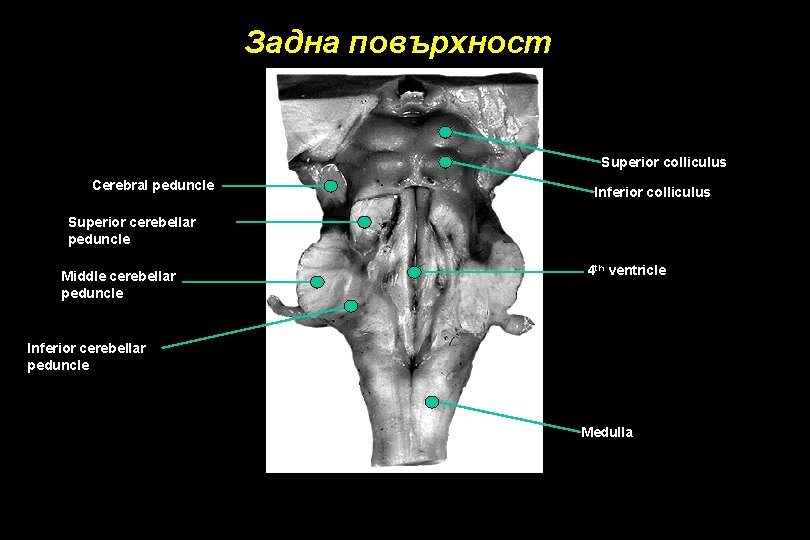 Задна повърхност Superior colliculus Cerebral peduncle Inferior colliculus Superior cerebellar peduncle Middle cerebellar peduncle