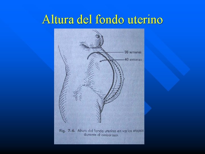 Altura del fondo uterino 