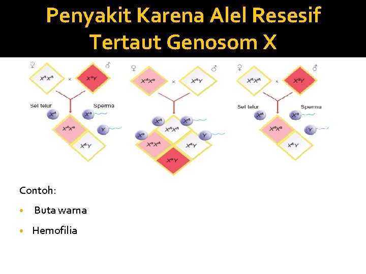 Penyakit Karena Alel Resesif Tertaut Genosom X Contoh: • Buta warna • Hemofilia 