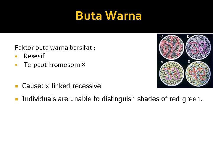 Buta Warna Faktor buta warna bersifat : • Resesif • Terpaut kromosom X Cause: