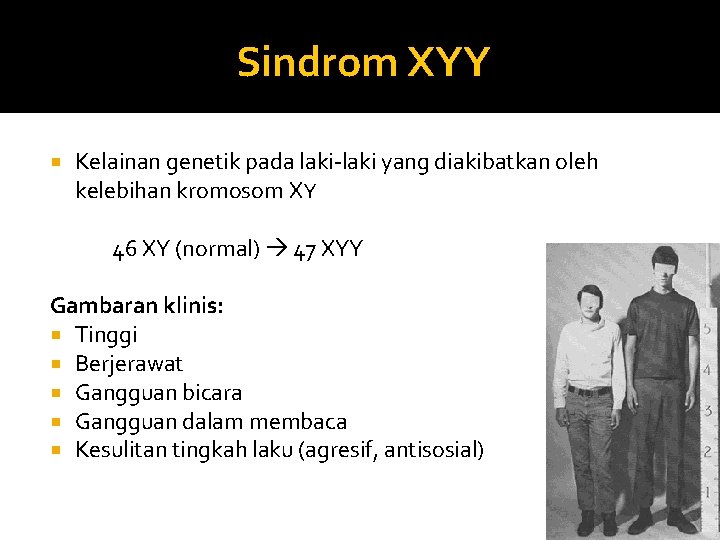 Sindrom XYY Kelainan genetik pada laki-laki yang diakibatkan oleh kelebihan kromosom XY 46 XY