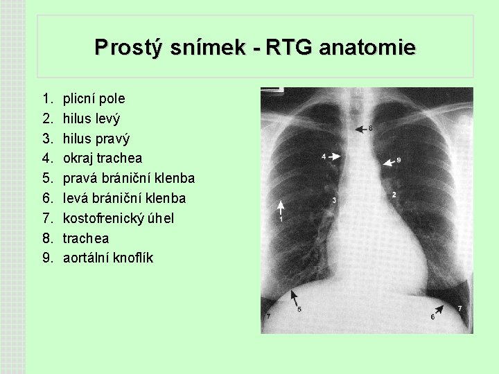 Prostý snímek - RTG anatomie 1. 2. 3. 4. 5. 6. 7. 8. 9.