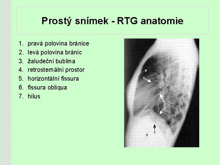 Prostý snímek - RTG anatomie 1. 2. 3. 4. 5. 6. 7. pravá polovina