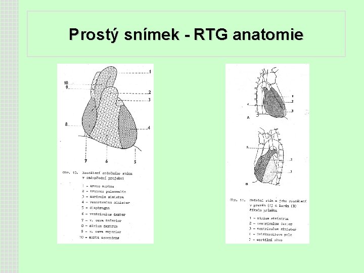 Prostý snímek - RTG anatomie 