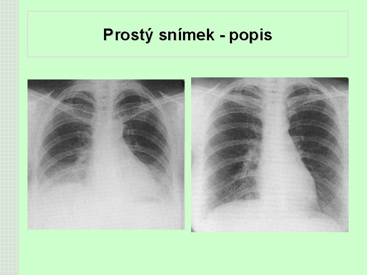 Prostý snímek - popis 