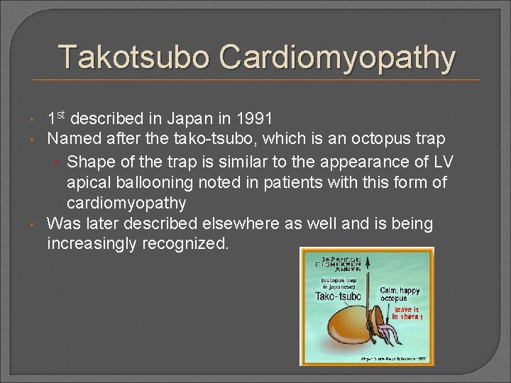 Takotsubo Cardiomyopathy 1 st described in Japan in 1991 Named after the tako-tsubo, which