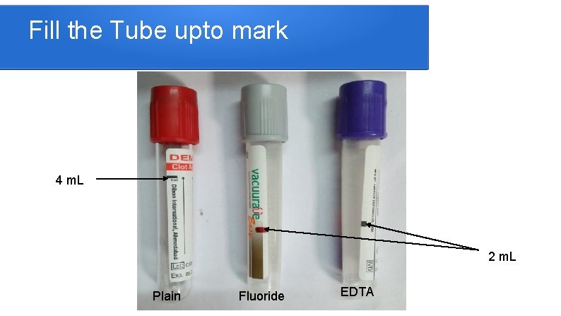 Fill the Tube upto mark 4 m. L 2 m. L Plain Fluoride EDTA