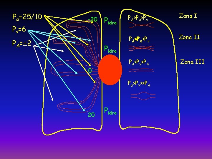 Pa=25/10 -20 Pv=6 PA= 2 Pidro 0 PA>Pa>Pv Zona I PAa>P >PAa>Pv Zona II
