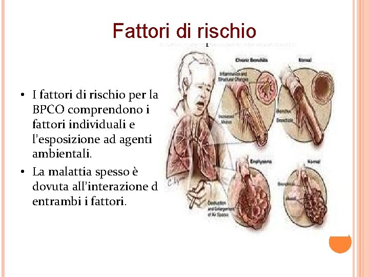 Fattori di rischio • I fattori di rischio per la BPCO comprendono i fattori