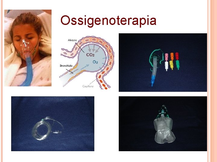 Ossigenoterapia 