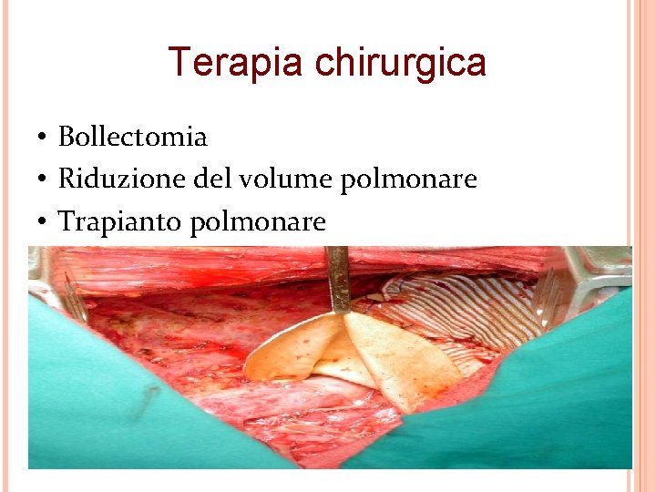 Terapia chirurgica • Bollectomia • Riduzione del volume polmonare • Trapianto polmonare 