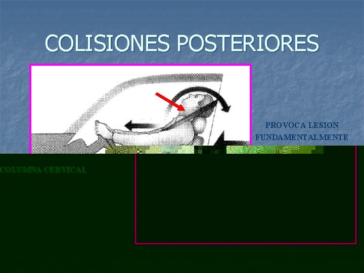 COLISIONES POSTERIORES PROVOCA LESION FUNDAMENTALMENTE EN LA COLUMNA CERVICAL 11 