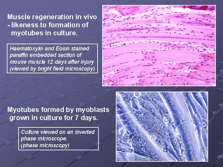 Muscle regeneration in vivo - likeness to formation of myotubes in culture. Haematoxylin and