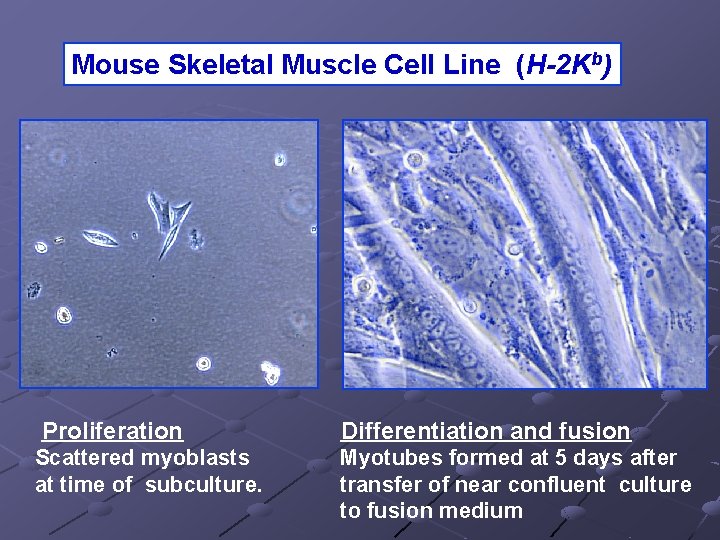 Mouse Skeletal Muscle Cell Line (H-2 Kb) Proliferation Scattered myoblasts at time of subculture.