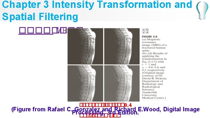 Chapter 3 Intensity Transformation and Spatial Filtering ���� MRI image � ������� � ���