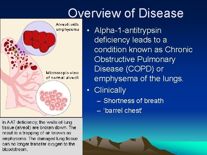 Overview of Disease • Alpha-1 -antitrypsin deficiency leads to a condition known as Chronic