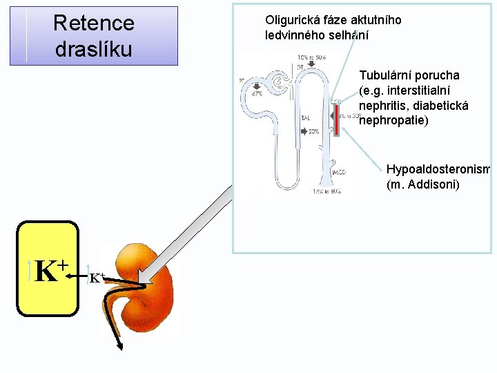 Retence draslíku Oligurická fáze aktutního ledvinného selhání Tubulární porucha (e. g. interstitialní nephritis, diabetická
