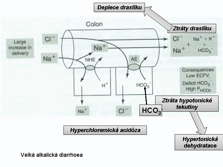 Deplece draslíku Ztráty draslíku HCO 3 Ztráta hypotonické tekutiny - Hyperchloremická acidóza Hypertonická dehydratace
