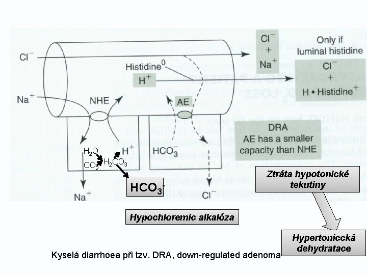 H 2 O CO 2 H 2 CO 3 HCO 3 - Ztráta hypotonické