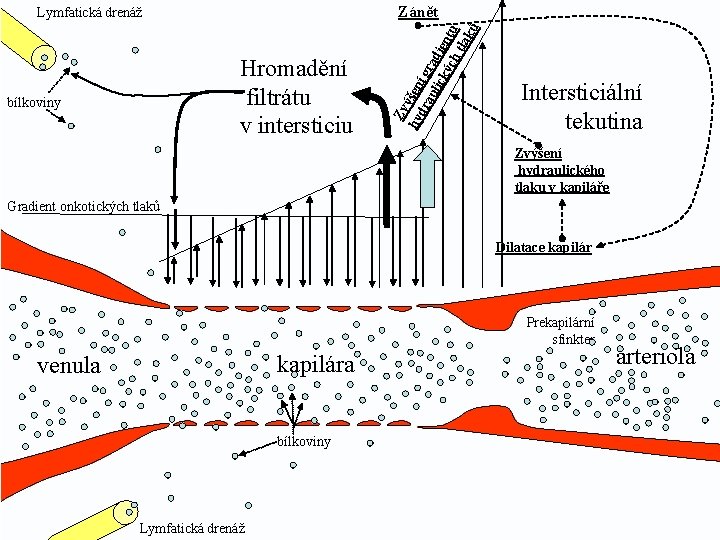 Hromadění filtrátu v intersticiu bílkoviny Zv hy ýšen dr í g au ra lic