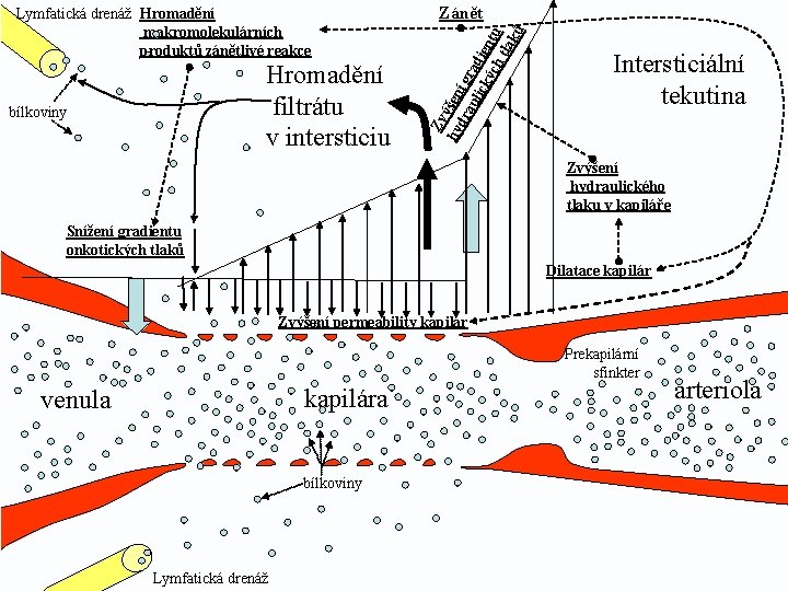 Hromadění filtrátu v intersticiu bílkoviny Zánět Zv hy ýšen dr í g au ra