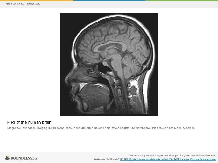 Introduction to Psychology MRI of the human brain Magnetic Resonance Imaging (MRI) scans of