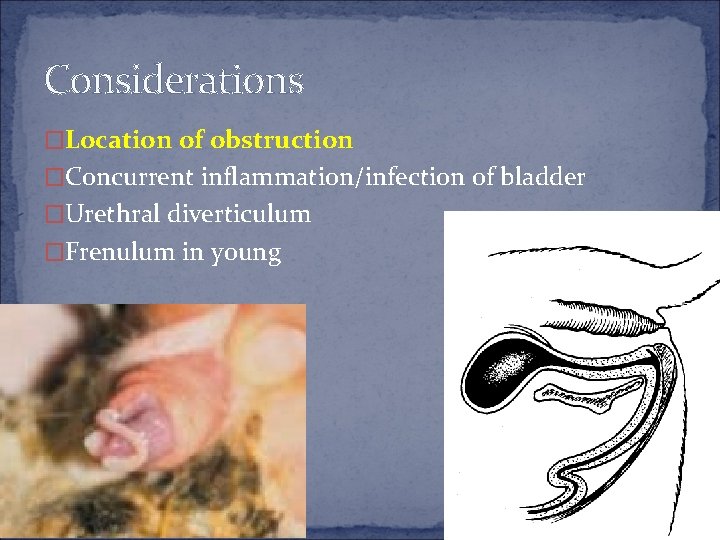 Considerations �Location of obstruction �Concurrent inflammation/infection of bladder �Urethral diverticulum �Frenulum in young 