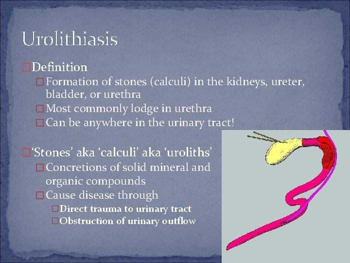 Urolithiasis �Definition � Formation of stones (calculi) in the kidneys, ureter, bladder, or urethra