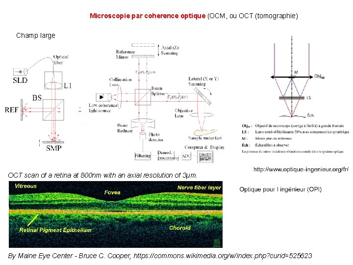 Microscopie par coherence optique (OCM, ou OCT (tomographie) Champ large OCT scan of a