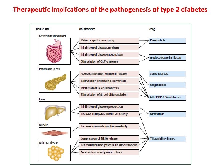 Therapeutic implications of the pathogenesis of type 2 diabetes 