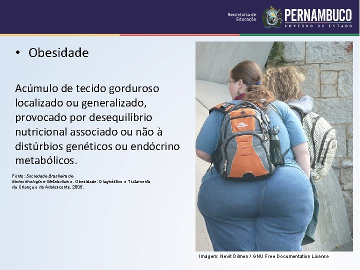  • Obesidade Acúmulo de tecido gorduroso localizado ou generalizado, provocado por desequilíbrio nutricional