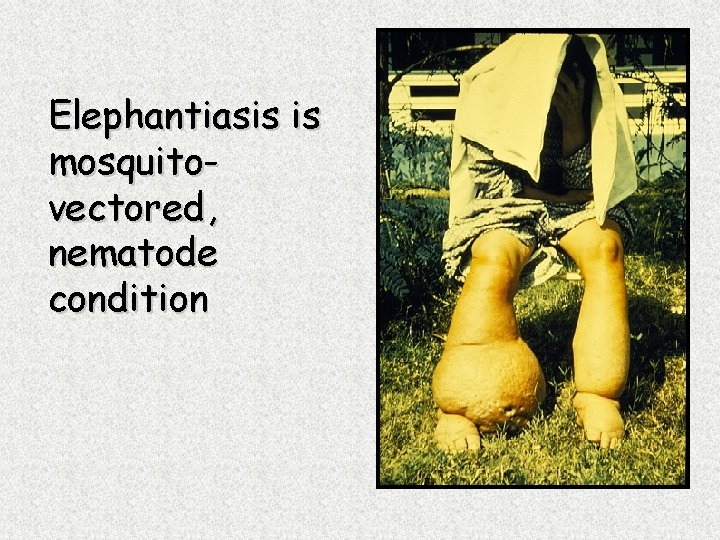 Elephantiasis is mosquitovectored, nematode condition 