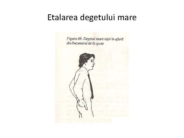 Etalarea degetului mare 